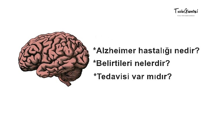 Alzheimer hastalığı tedavisi nedir