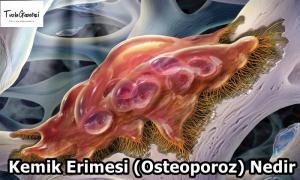 Kemik Erimesi (Osteoporoz) Nedir