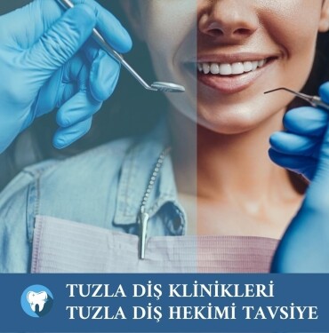 Tuzla Diş Klinikleri Tuzla Diş Hekimi Tavsiye randevu