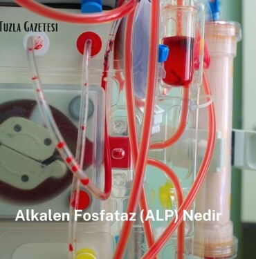 Alkalen Fosfataz (ALP) Nedir