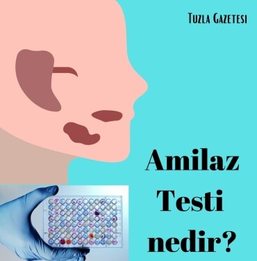 Amilaz nedir