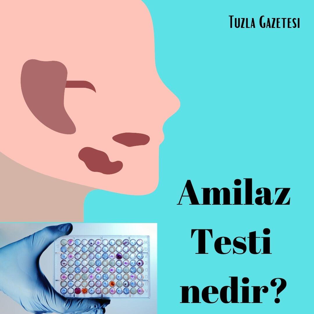 Amilaz hastaligi nedir?