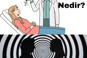 Hipnoz Nedir