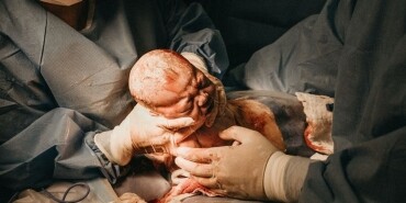 Doğum Nedir Doğum Çeşitleri Nelerdir