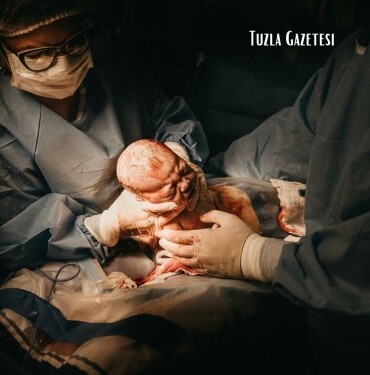 Doğum Nedir Doğum Çeşitleri Nelerdir