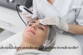 Siyah noktaları arındıran cilt bakım trendi nedir, Siyah noktaları arındıran cilt bakım trendi Fiddy metodu nedir