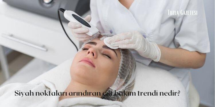 Siyah noktaları arındıran cilt bakım trendi nedir, Siyah noktaları arındıran cilt bakım trendi Fiddy metodu nedir
