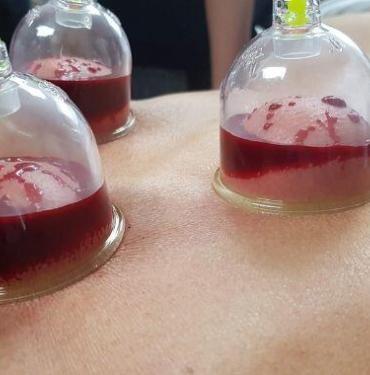 Ekim Ayı Hacamat Günleri 2023