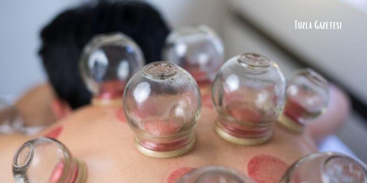 Hacamat nedir pendik