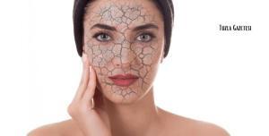 Sonbahar ve Kış Aylarında Cilt Neden Kurur, Cilt kuruluğu nasıl geçer