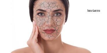 Sonbahar ve Kış Aylarında Cilt Neden Kurur, Cilt kuruluğu nasıl geçer