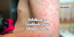 Bebeklerde ve Çocuklarda Besin Alerjileri Arttı