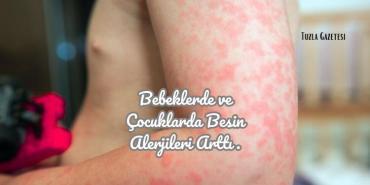 Bebeklerde ve Çocuklarda Besin Alerjileri Arttı