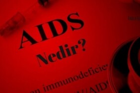 AIDS nedir