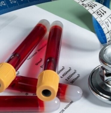 Metabolik Sendrom Nedir?